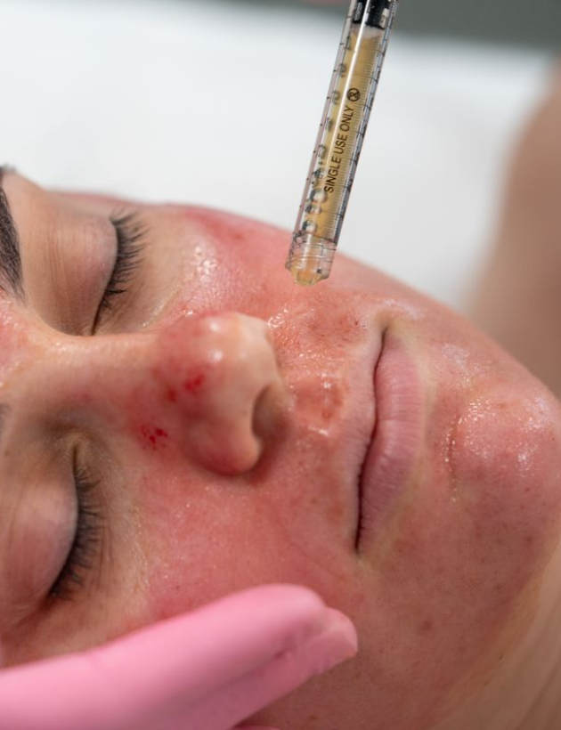 Lamia Radiant Facial (Vampire)